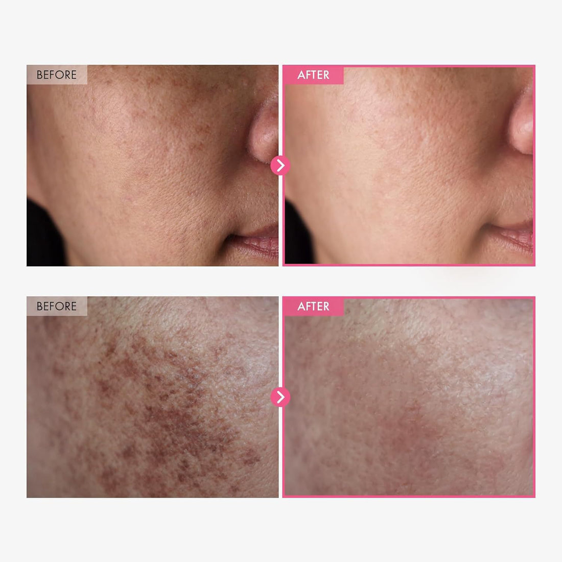 Dark spot corrector serum